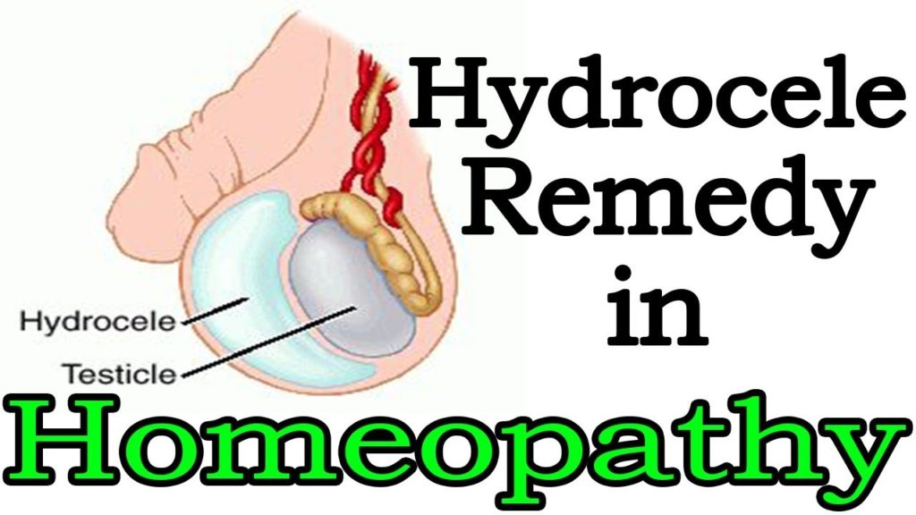 Hydrocele Symptoms Causes Homeopathic Treatment Dr Anki Reddys