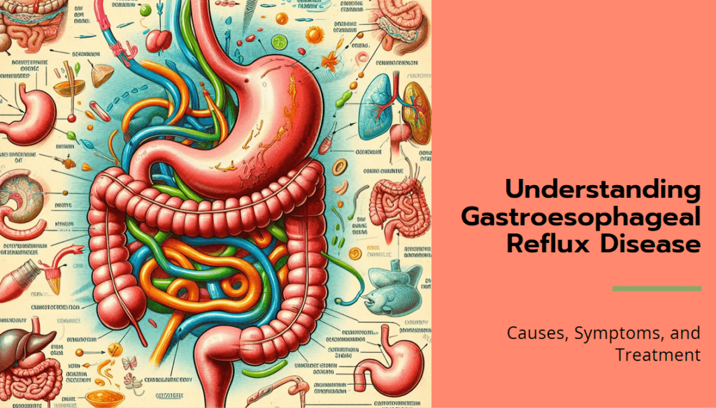 Gastroesophageal Reflux Disease Dr Anki Reddys