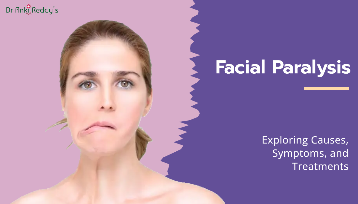 Facial Paralysis: Causes, Symptoms, and Treatment Options