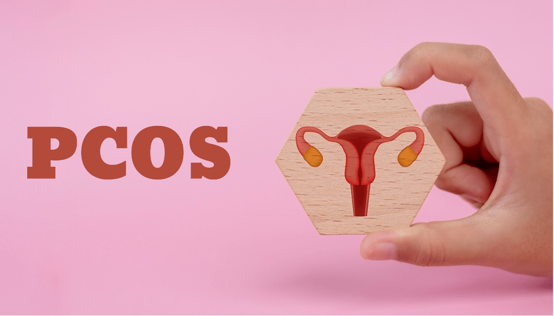 What is PCOS in Women? Causes, Symptoms, and Treatment