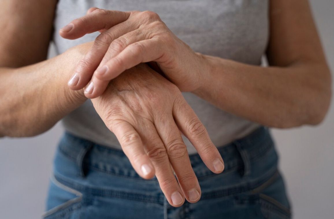 Homeopathy Treatment for Rheumatoid Arthritis